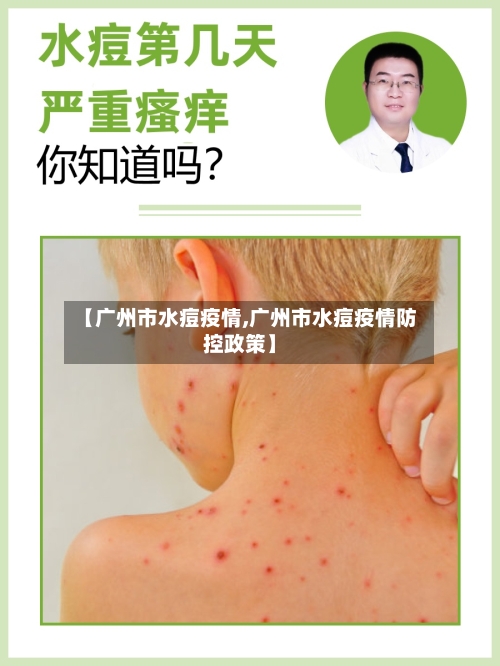 【广州市水痘疫情,广州市水痘疫情防控政策】-第1张图片